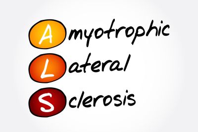 Физическая активность защищала от развития бокового амиотрофического склероза